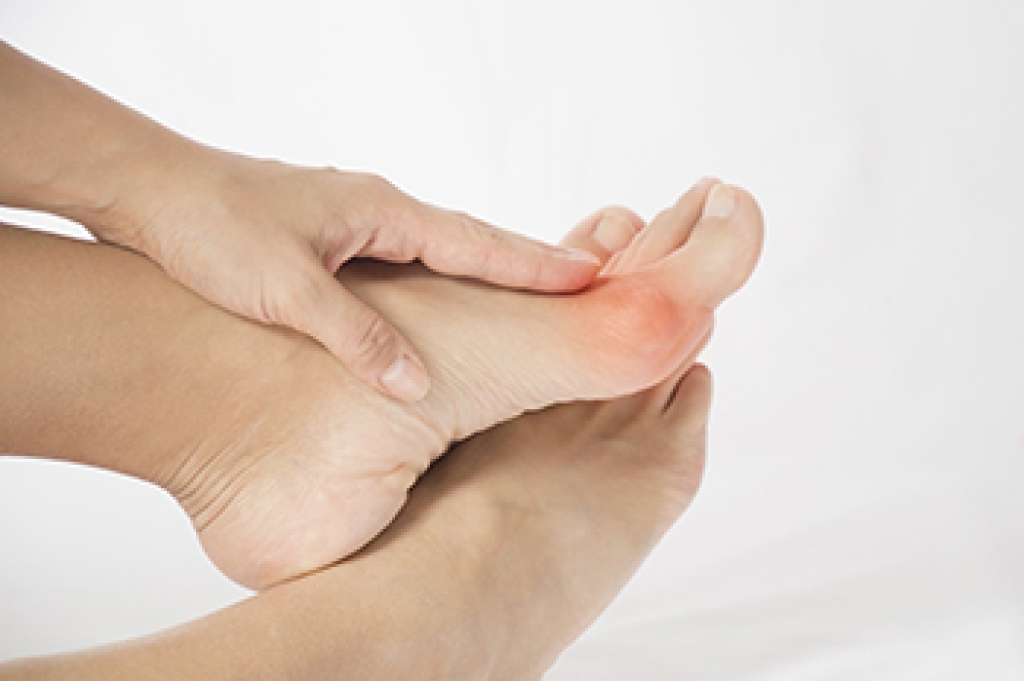 How Bunions Affect Your Feet