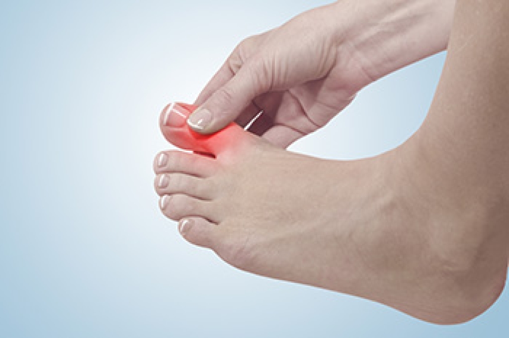 Big Toe Pain Can Point to Injury or Gout