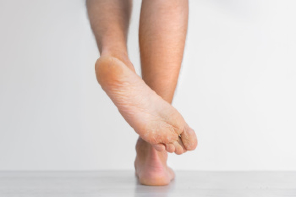 Athlete’s Foot and When to See a Podiatrist