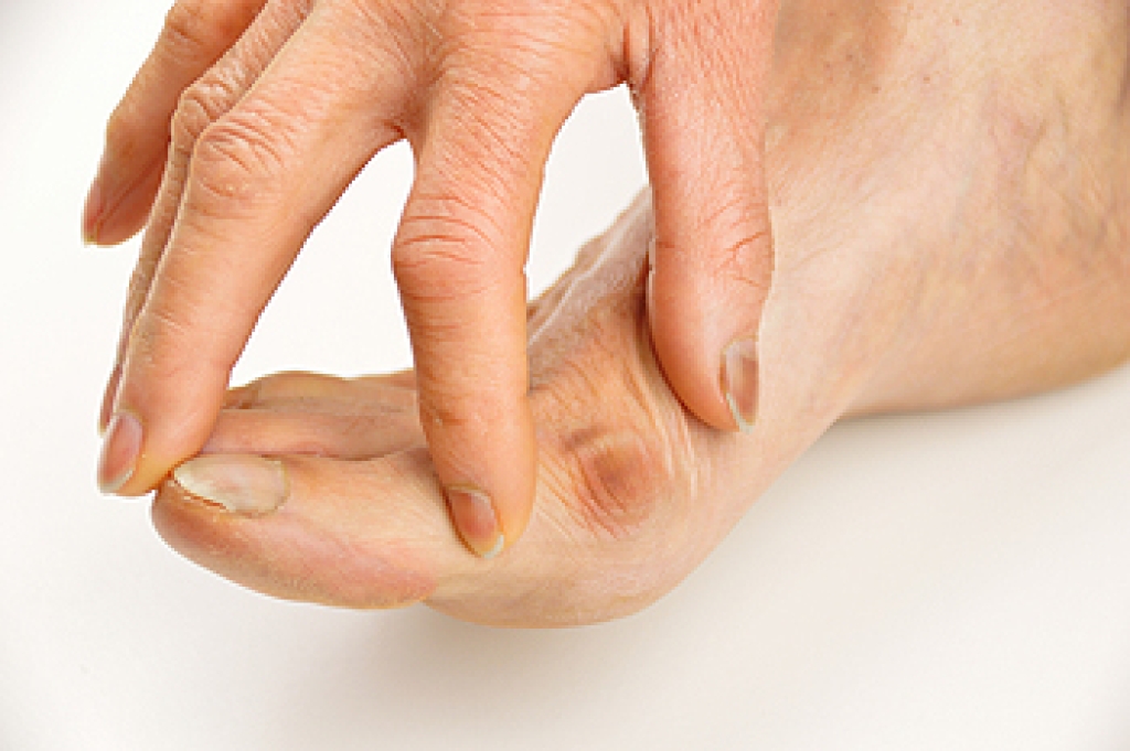 When to See a Podiatrist for Bunions