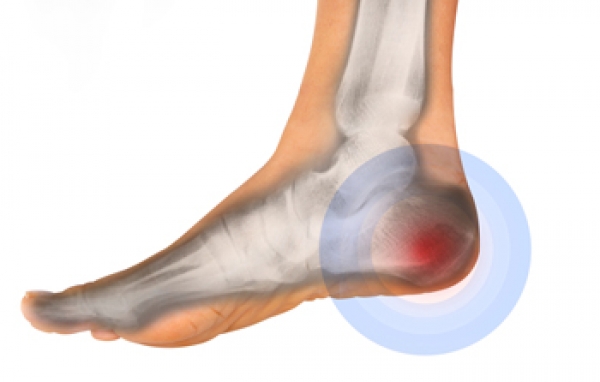 Reason of online foot heel pain