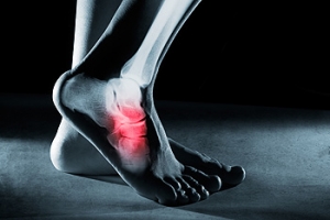 Why Does the Outside of My Foot Hurt?