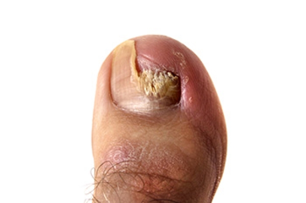 Nails That Change Color and Texture