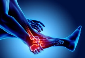 How Rheumatoid Arthritis Can Affect the Ankles