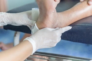 Heel Bone Pressure Injuries